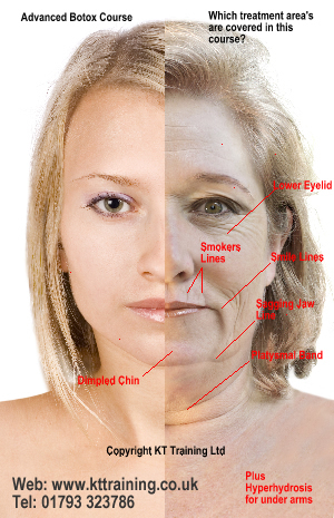 advanced botox